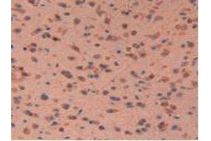 IHC-P analysis of Mouse Brain Tissue, with DAB staining. (LIFR 抗体  (AA 381-485))