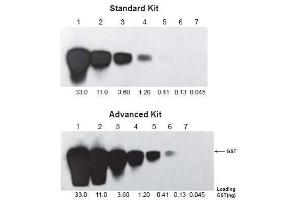 Two similar blots were processed with the same procedures using different ONE-HOUR WesternTM Kits: Standard (ABIN491508) and Advanced (ABIN491500). (ONE-HOUR Western Basic Kit (小鼠))