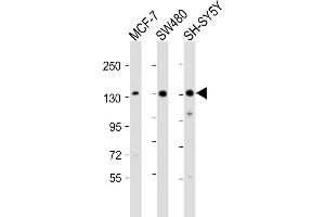 All lanes : Anti-SRG Antibody (C-term) at 1:2000 dilution Lane 1: MCF-7 whole cell lysate Lane 2: S whole cell lysate Lane 3: SH-SY5Y whole cell lysate Lysates/proteins at 20 μg per lane. (SRGAP2 抗体  (C-Term))
