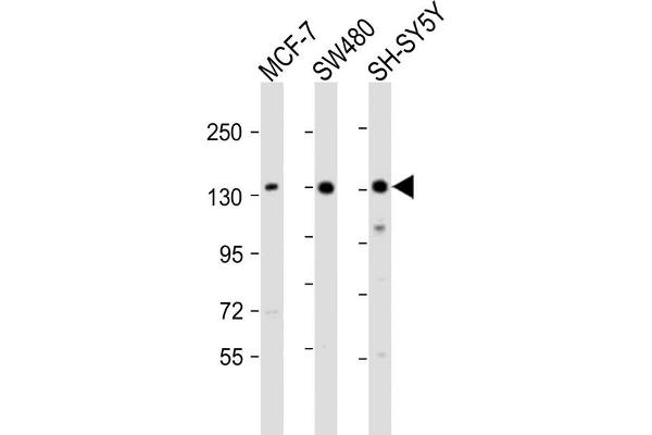 SRGAP2 antibody  (C-Term)