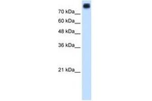 Image no. 2 for anti-P-Cadherin (CDH3) (AA 187-236) antibody (ABIN205074) (P-Cadherin 抗体  (AA 187-236))