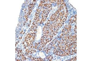 Immunohistochemistry of paraffin-embedded rat ovary using HSD3B1 Rabbit mAb (ABIN7267801) at dilution of 1:100 (40x lens). (HSD3B1 抗体)