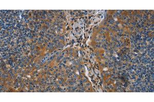Immunohistochemistry of paraffin-embedded Human tonsil using NRN1 Polyclonal Antibody at dilution of 1:40 (NRN1 抗体)