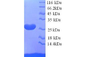 Ephrin A5 (EFNA5) (AA 21-203), (full length) protein (His tag) (Ephrin A5 Protein (EFNA5) (AA 21-203, full length) (His tag))