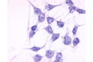 Anti-P2RY6 / P2Y6 antibody immunocytochemistry (ICC) staining of untransfected HEK293 human embryonic kidney cells. (P2RY6 抗体  (C-Term))