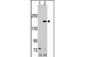 Western blot analysis of SRC1 (arrow) using rabbit NCOA1 polyclonal antibody . (NCOA1 抗体  (N-Term))