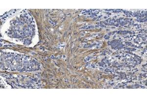 IHC analysis of Alpha B Crystallin/CRYAB using anti-Alpha B Crystallin/CRYAB antibody (ABIN7601209).