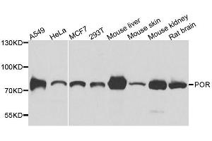 Western blot analysis of extracts of various cell lines, using POR antibody. (POR 抗体  (AA 1-250))