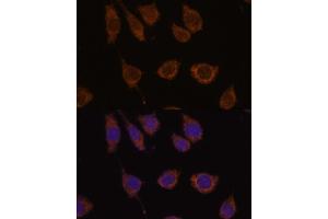 Immunofluorescence analysis of L929 cells using CB antibody (ABIN7266072) at dilution of 1:100. (CA5B 抗体  (AA 1-317))