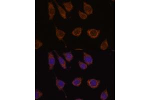 Immunofluorescence analysis of L929 cells using CB antibody (ABIN7266072) at dilution of 1:100. (CA5B 抗体  (AA 1-317))
