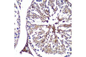 Immunohistochemistry of paraffin-embedded Rat testis using PASK Rabbit pAb (ABIN6128413, ABIN6145248, ABIN6145249 and ABIN6224850) at dilution of 1:100 (40x lens).