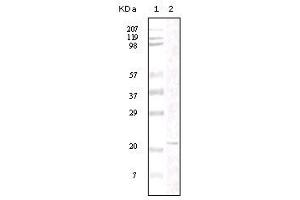 Western blot analysis using FAK mouse mAb against truncated FAK recombinant protein. (FAK 抗体)