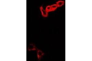 Immunofluorescent analysis of MOCS3 staining in A549 cells. (MOCS3 抗体)