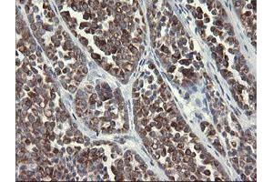 Image no. 11 for anti-Src-like-adaptor 2 (SLA2) antibody (ABIN1500949)