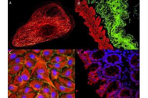 Immunofluorescence (IF) image for Rabbit anti-Mouse IgG antibody (Atto 594) (ABIN1043991)