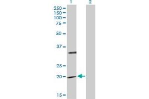 Western Blot analysis of PTPMT1 expression in transfected 293T cell line by PTPMT1 MaxPab polyclonal antibody. (PTPMT1 抗体  (AA 1-201))