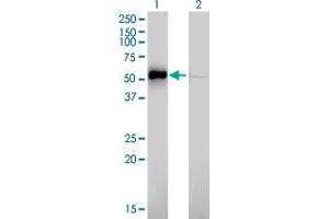 Western Blot analysis of ILK expression in transfected 293T cell line by ILK monoclonal antibody (M01), clone 4F10. (ILK 抗体  (AA 341-452))