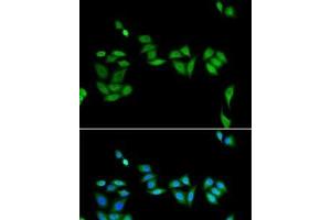 Immunofluorescence analysis of U2OS cells using JADE1 Polyclonal Antibody (PHF17 抗体)