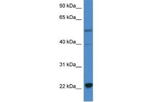 WB Suggested Anti-IL18 AntibodyTitration: 1. (IL-18 抗体  (C-Term))