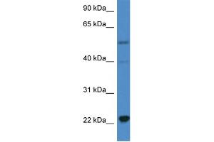 WB Suggested Anti-IL18 AntibodyTitration: 1. (IL-18 抗体  (C-Term))