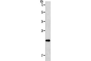 Gel: 12 % SDS-PAGE, Lysate: 40 μg, Lane: Human liver cancer tissue, Primary antibody: ABIN7191632(NEUROG1 Antibody) at dilution 1/400, Secondary antibody: Goat anti rabbit IgG at 1/8000 dilution, Exposure time: 1 minute (Neurogenin 1 抗体)