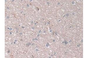 Immunohistochemistry (IHC) image for anti-N-Acylsphingosine Amidohydrolase (Acid Ceramidase) 1 (ASAH1) (AA 144-395) antibody (ABIN7434806)