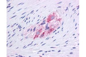 GLUD1 antibody was used for immunohistochemistry at a concentration of 4-8 ug/ml. (GLUD1 抗体  (N-Term))