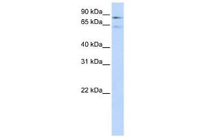 Factor XIII B Polypeptide antibody used at 1 ug/ml to detect target protein. (F13B 抗体  (Middle Region))