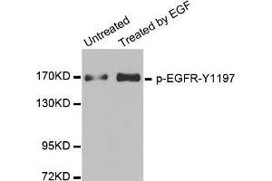 Western blot analysis of extracts from HUVEC cells, using Phospho-EGFR-Y1197 antibody. (EGFR 抗体  (pTyr1197))