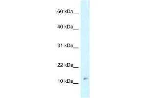 Western Blot showing RPL37 antibody used at a concentration of 1 ug/ml against MCF7 Cell Lysate (RPL37 抗体  (Middle Region))