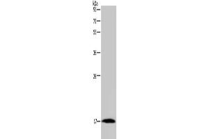 Gel: 10 % SDS-PAGE, Lysate: 40 μg, Lane: Mouse heart tissue, Primary antibody: ABIN7191408(MARVELD1 Antibody) at dilution 1/300, Secondary antibody: Goat anti rabbit IgG at 1/8000 dilution, Exposure time: 10 minutes