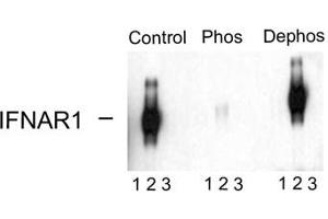 Image no. 2 for anti-Interferon alpha/beta Receptor 1 (IFNAR1) (pSer535), (Ser539) antibody (ABIN228236) (IFNAR1 抗体  (pSer535, Ser539))