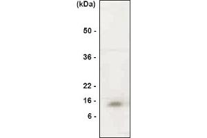 Western blot analysis.