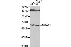 Western blot analysis of extracts of various cell lines, using MGAT1 antibody (ABIN6293367) at 1:1000 dilution. (MGAT1 抗体)