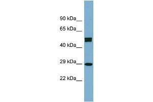 WB Suggested Anti-HOXC8 Antibody Titration: 0. (HOXC8 抗体  (Middle Region))