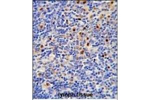 Formalin-fixed and paraffin-embedded human lymph tissue reacted with LTA4H Antibody (Center) (ABIN650745 and ABIN2839464) , which was peroxidase-conjugated to the secondary antibody, followed by DAB staining. (LTA4H 抗体  (AA 163-191))