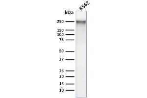 Western Blotting (WB) image for anti-Spectrin alpha 1, Erythrocytic (SPTA1) (AA 356-475) antibody (ABIN6940644)