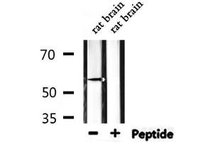 Western blot analysis of extracts from rat brain, using ZSCAN22 Antibody.