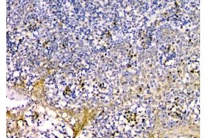 IHC analysis of GM130 using anti-GM130 antibody (ABIN6719433). (Golgin A2 (GOLGA2) (AA 796-913) 抗体)