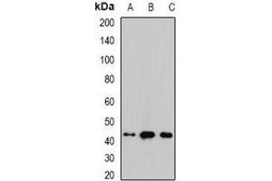 Western blot analysis of Malin expression in mouse brain (A), mouse heart (B), rat liver (C) whole cell lysates. (NHLRC1 抗体)