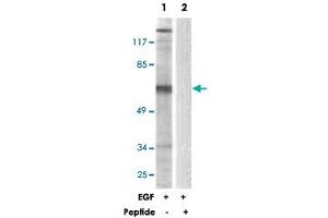 Western blot analysis of extracts from NIH/3T3 cells, treated with EGF (200 ng/mL, 30 mins), using STAM2 polyclonal antibody . (STAM2 抗体)
