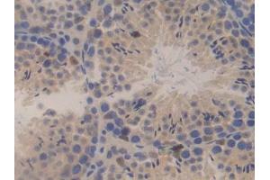 DAB staining on IHC-P; Samples: Mouse Testis Tissue (SSFA2 抗体  (AA 587-802))