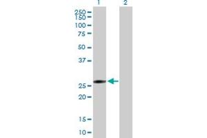 Western Blot analysis of FLJ40504 expression in transfected 293T cell line by FLJ40504 MaxPab polyclonal antibody.