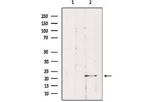 Western blot analysis of extracts from HepG2, using RAB1B Antibody. (RAB1B 抗体  (Internal Region))