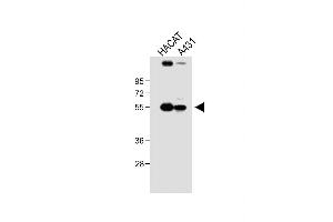 All lanes : Anti-SG Antibody (N-term) at 1:1000 dilution Lane 1: HACAT whole cell lysate Lane 2: A431 whole cell lysate Lysates/proteins at 20 μg per lane. (SGPP1 抗体  (N-Term))