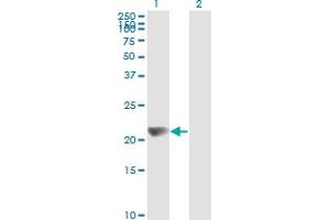 Western Blotting (WB) image for anti-Non-Metastatic Cells 1, Protein (NM23A) Expressed in (NME1) (AA 43-152) antibody (ABIN562004)