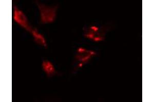 ABIN6274422 staining HeLa cells by IF/ICC. (TBC1D3 抗体)