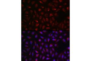 Immunofluorescence (IF) image for anti-Succinate Dehydrogenase Complex, Subunit A, Flavoprotein (Fp) (SDHA) (AA 385-664) antibody (ABIN3023400)