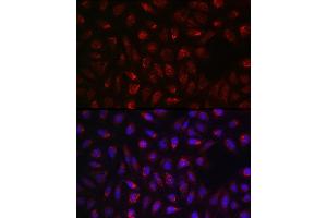Immunofluorescence analysis of U2OS cells using SDHA Rabbit pAb (ABIN3023399, ABIN3023400, ABIN3023401, ABIN1682638 and ABIN6219706) at dilution of 1:100 (40x lens). (SDHA 抗体  (AA 385-664))