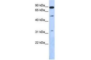 Image no. 1 for anti-SUMO1/sentrin Specific Peptidase 5 (SENP5) (AA 503-552) antibody (ABIN6743841) (SENP5 抗体  (AA 503-552))